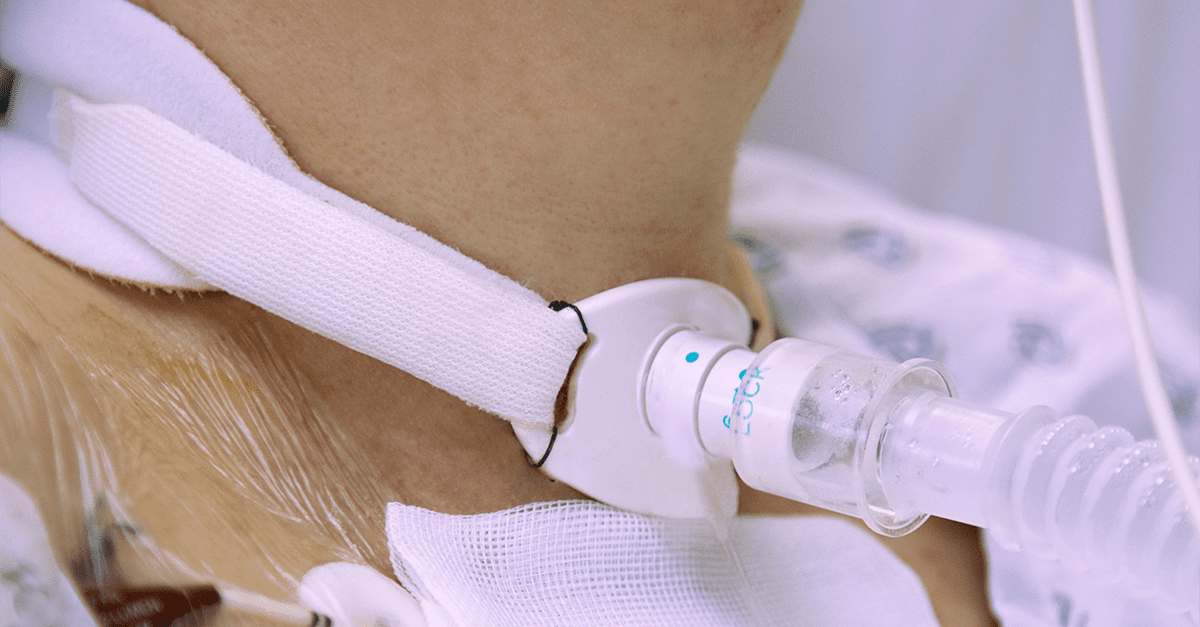 Respiratory Care Tracheostomy & Endotracheostomy & Our VELCRO® Brand Solutions